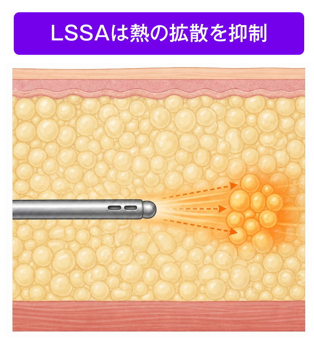 LSSA 熱拡散抑制