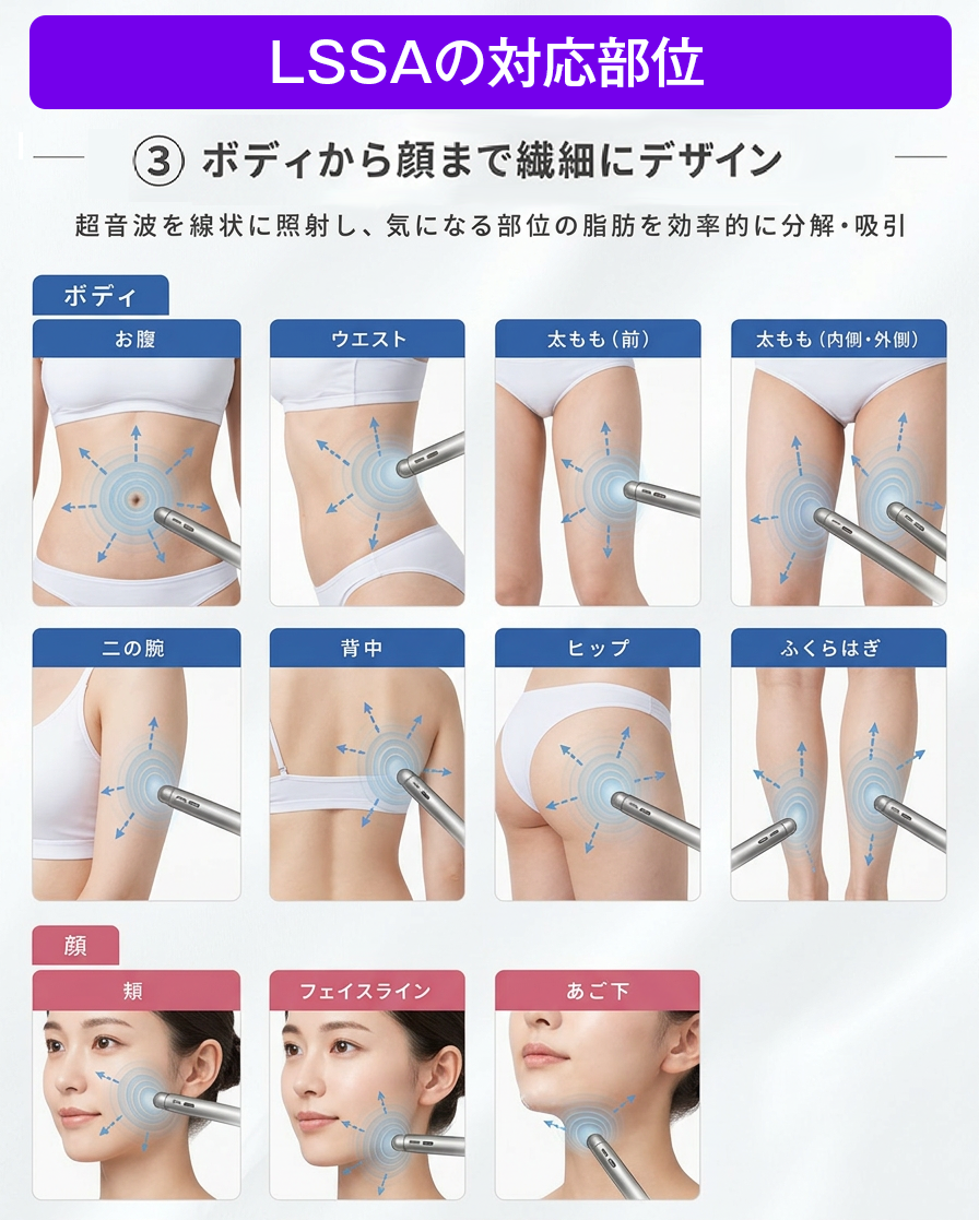 LSSA 顔とボディ対応
