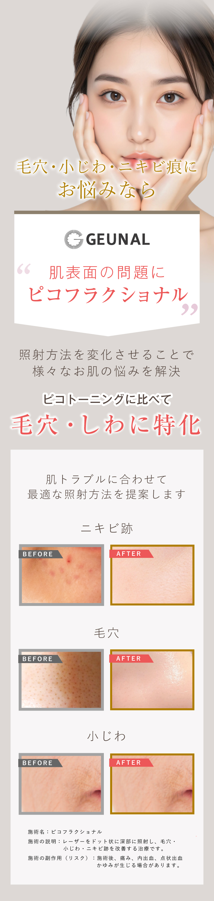ピコレーザーが選ばれる理由