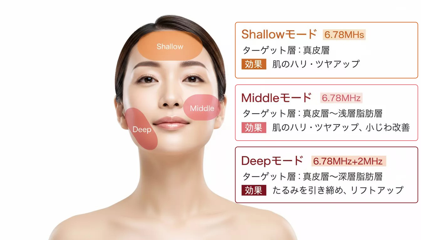 XERF ザーフ 照射モード Shallow Middle Deep 大阪梅田 美容皮膚科